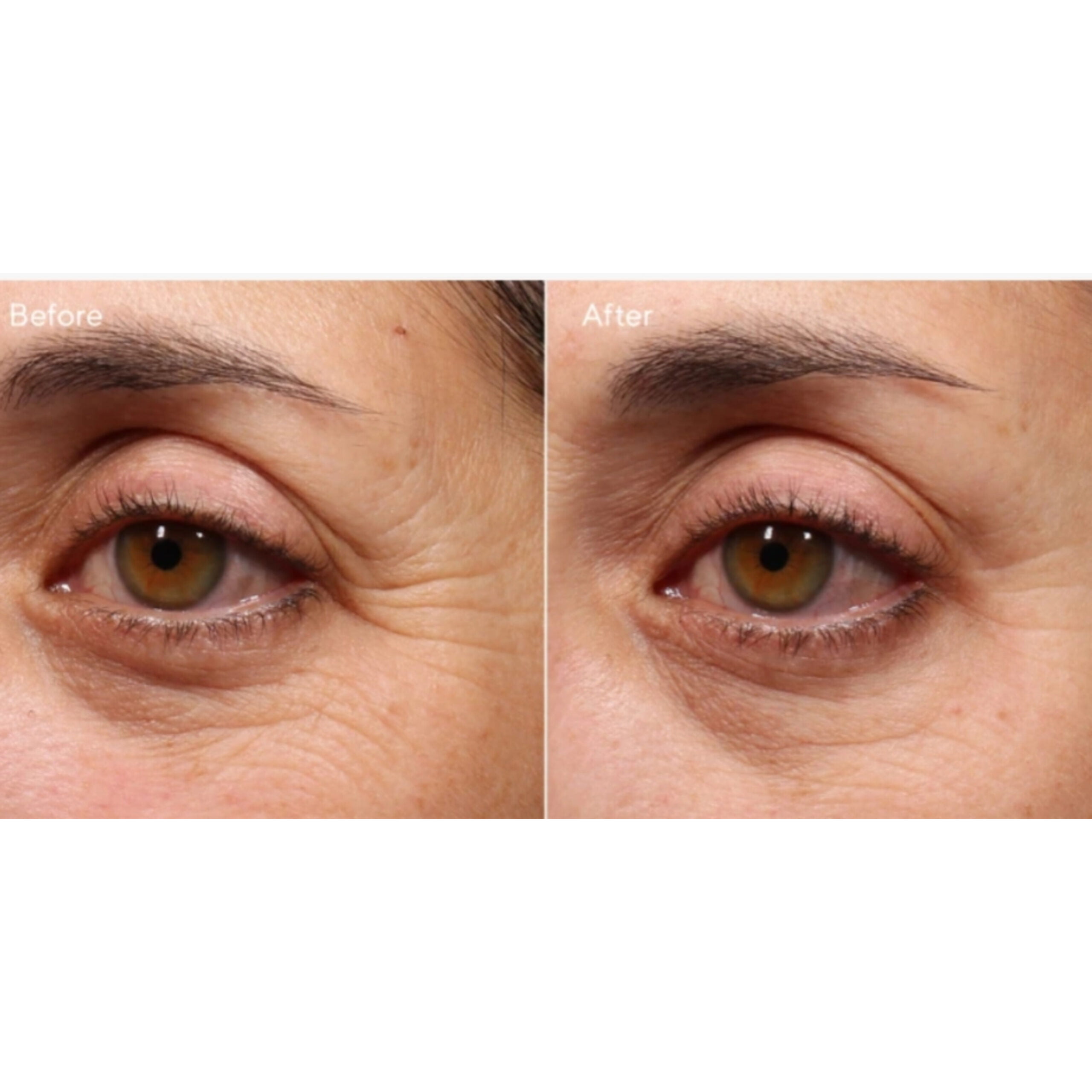 سرم دور چشم رتینول مورد جوانساز بسیار قوی MURAD 15ML 2 سرم دور چشم رتینول مورد جوانساز بسیار قوی MURAD 15ML - Image 2