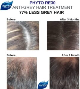 اسپری درمانی رفع سفیدی ریشه مو فیتو رنگ ریشه طبیعی مو 50میل 4 اسپری درمان سفیدی مو