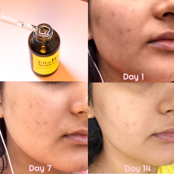 سرم ضد لک و روشن کننده نیاسینامید تیام 40 میلی لیتر TIAM 6 TIAM Vita B3 Source