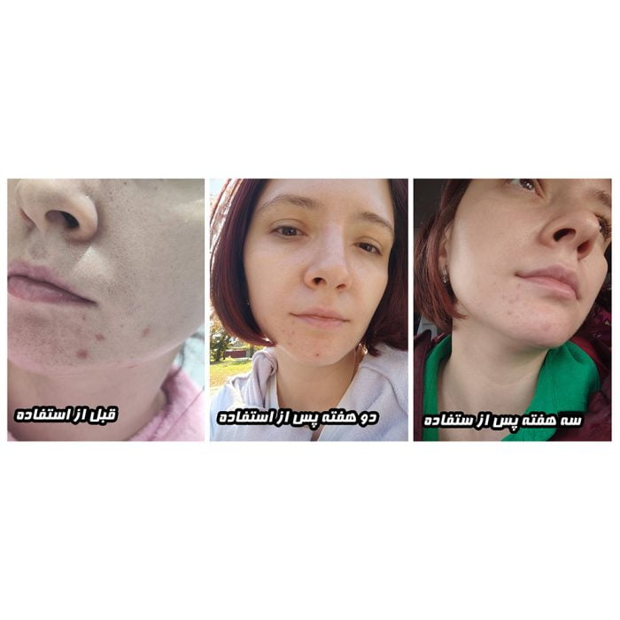 سرم ویتامین سی بیوتی آف جوسان حاوی سنتلا و ویتامین سی Centella + Vita C 30ml 8 سرم ویتامین سی بیوتی آف جوسان حاوی سنتلا و ویتامین سی Centella + Vita C 30ml - Image 8