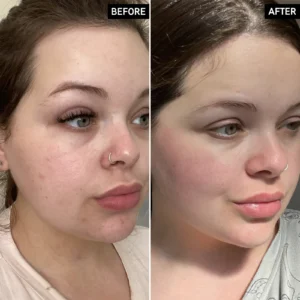 مرطوب کننده و آبرسان امگا واتر اینکی لیست 50 میلی لیتر 8 بهبود هیدراتاسیون و ظاهر پوست