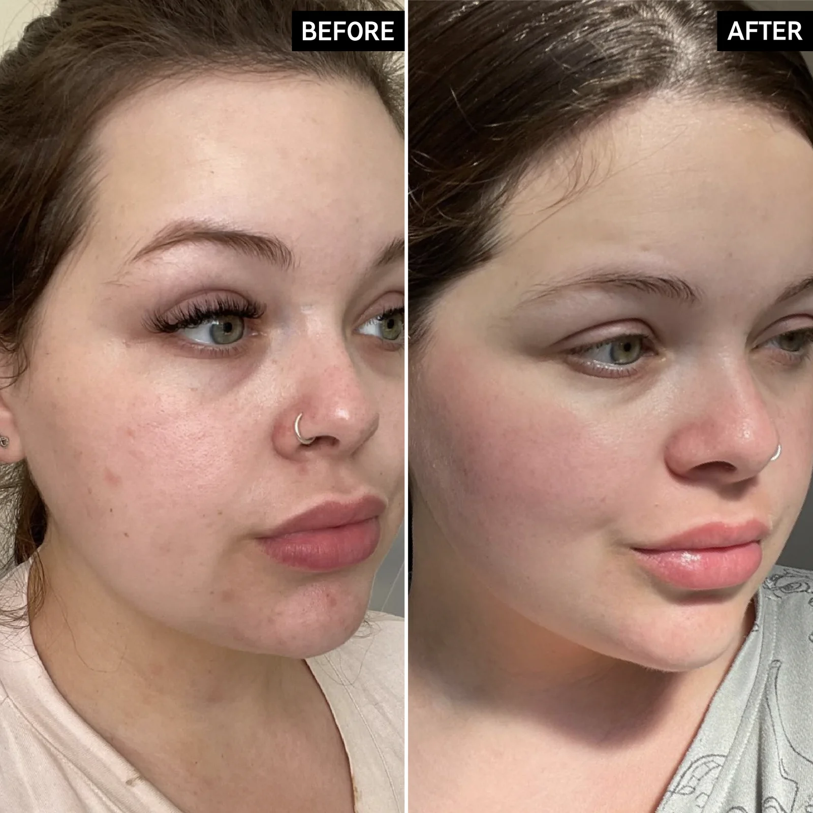 مرطوب کننده و آبرسان امگا واتر اینکی لیست 50 میلی لیتر 2 بهبود هیدراتاسیون و ظاهر پوست