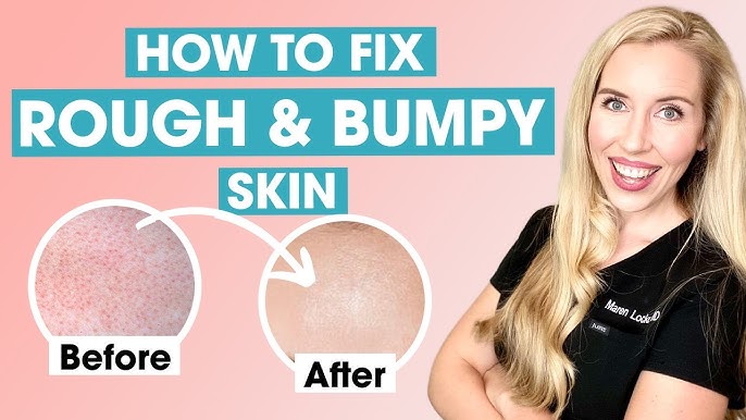 کرم مرطوب کننده و نرم کننده قوی سراوی 340 گرم 2 کرم مرطوب کننده و نرم کننده قوی سراوی 340 گرم - Image 2