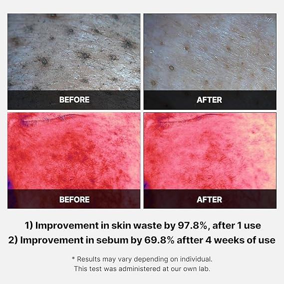 پد لایه بردار مدی کیوب پوست های مستعد آکنه 155 گرم 3 پد لایه بردار مدی کیوب پوست های مستعد آکنه 155 گرم - Image 3