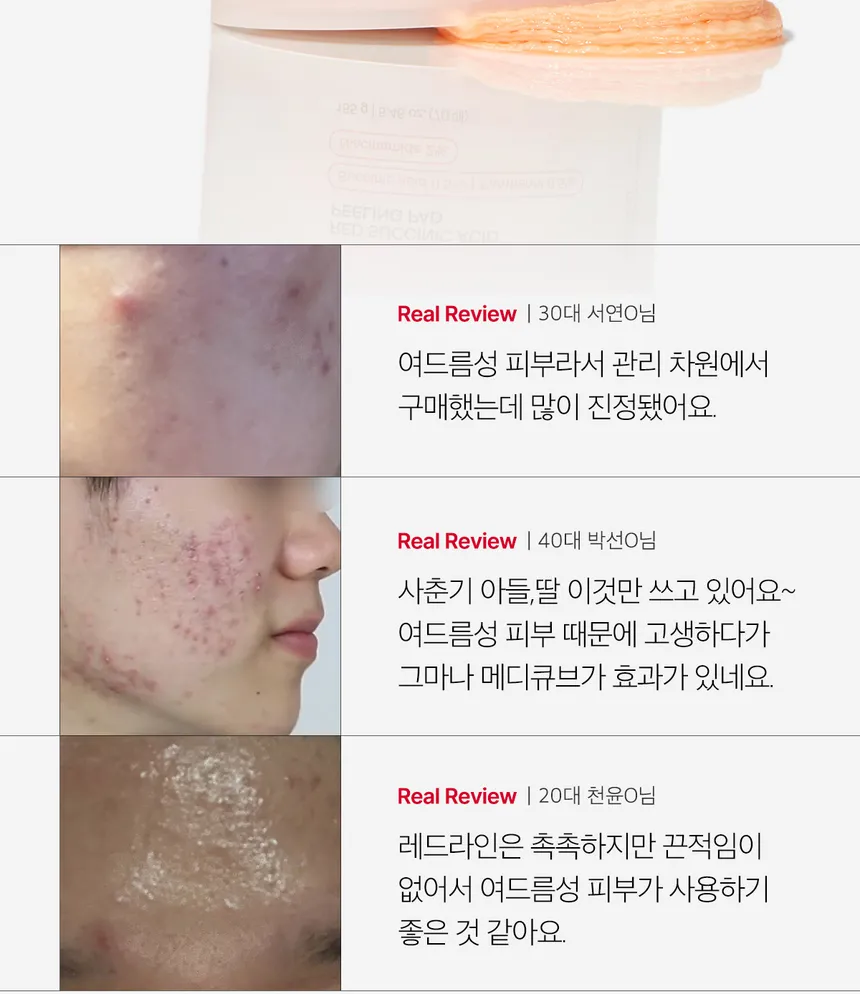 پد لایه بردار مدی کیوب پوست های مستعد آکنه 155 گرم 5 پد لایه بردار مدی کیوب پوست های مستعد آکنه 155 گرم - Image 5