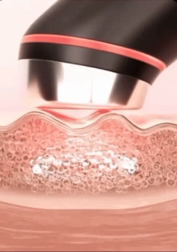 معجزه جوانسازی صورت با دستگاه 6 در 1 مدی کیوب 5 RPReplay Final1729205305 2