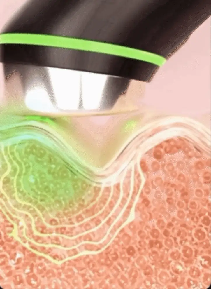معجزه جوانسازی صورت با دستگاه 6 در 1 مدی کیوب 4 مای