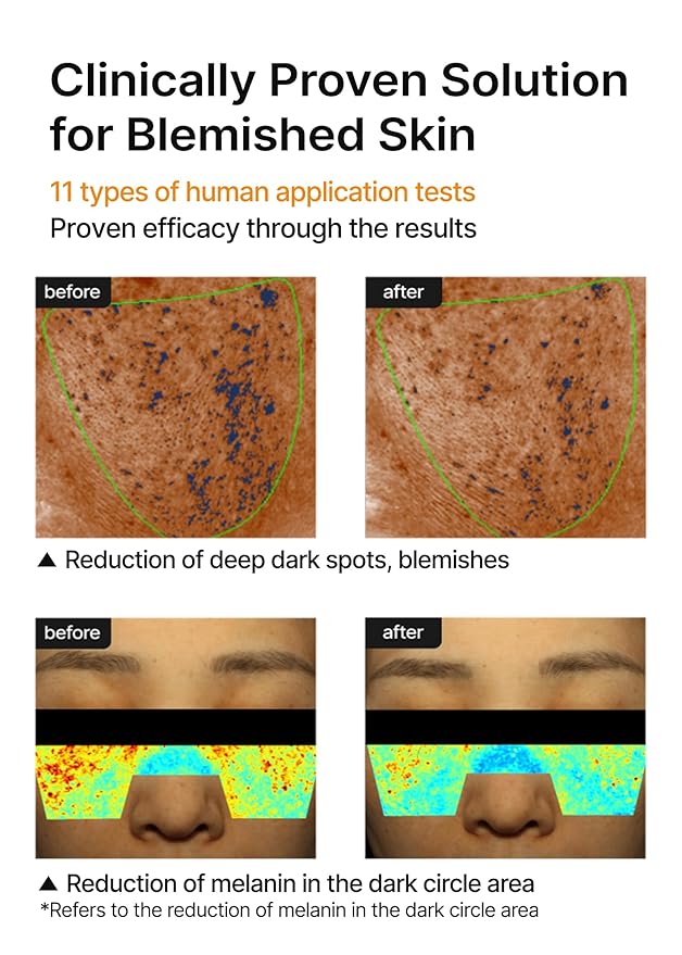 کرم روشن کننده لک و منافذ سلی مکس 35 میلی لیتر 3 کرم روشن کننده لک و منافذ سلی مکس 35 میلی لیتر - Image 3