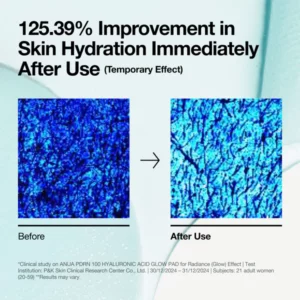 anua us toner 60 ea pdrn 100 hyaluronic acid glow pad 1170826105