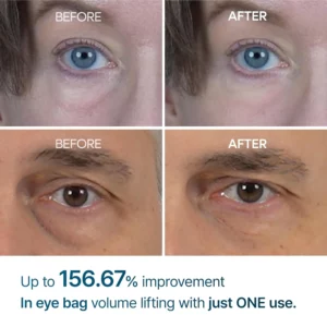 bf4d113bb4270afe4b569c0ba71ffa37